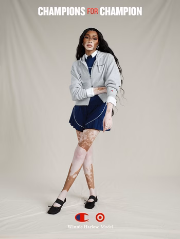 Winnie Harlow - Photo 8